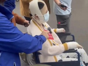 “事发后我坐不了油车，闻到汽油味就会吐”！女孩被前男友泼汽油烧伤致残案今日开庭