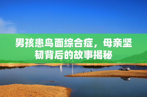 男孩患鸟面综合症，母亲坚韧背后的故事揭秘